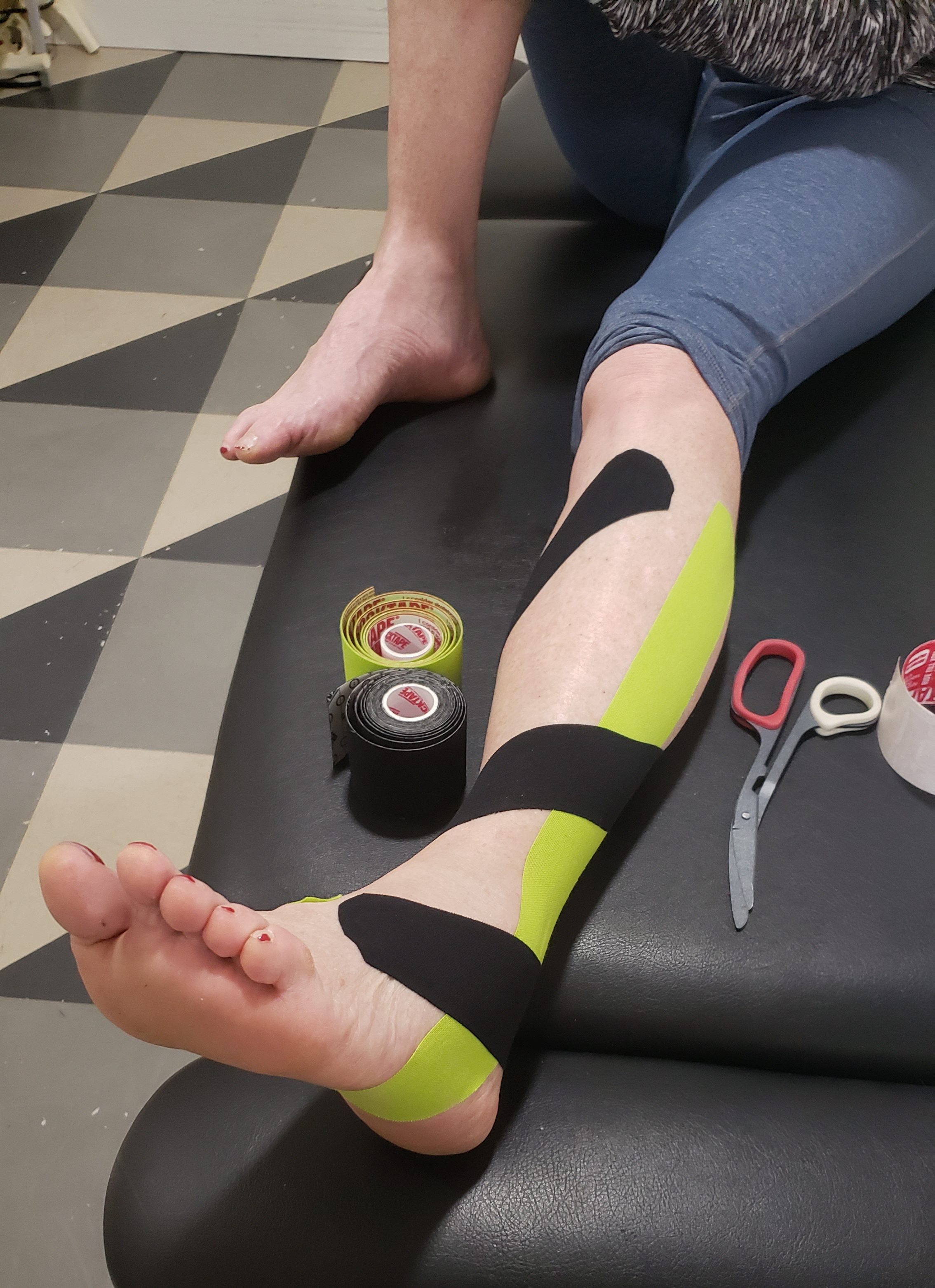 Plantar Fasciitis Tape