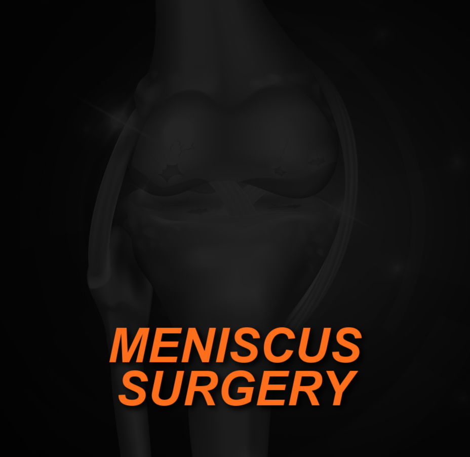 Does a Torn Meniscus Require Surgical Repair or Removal? 3 MENISCUS SURGERY