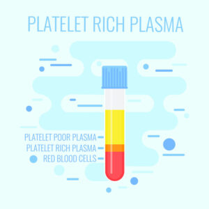 PRP Therapy: An Approach to Healing Pain and Injuries 1 Blue PRP Test Tube