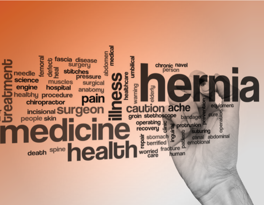 Hernia Healing: Start With Prevention 7 hernia 2