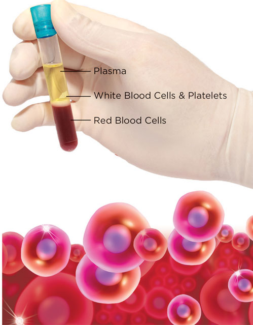 PRP Therapy: An Approach to Healing Pain and Injuries 3 How PRP works