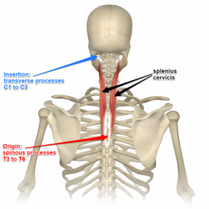 Understanding the Spinotransversales: The Superficial Intrinsic Muscles of the Back 2 spinotransversales Splenius Cervicis
