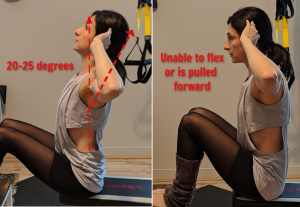 Thoracic Assessment