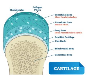 Cartilage Vector Illustration. Scheme Of Chondrocytes, Collagen Fibers, Calcified, Subchondral And Cancellous Bone. Diagram Of Superficial, Transition Zone.