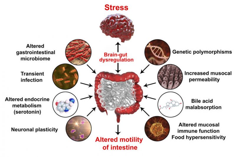 Irritable Bowel Syndrome IBS Medical Concept gut health