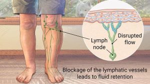 Lymphatic Circulation