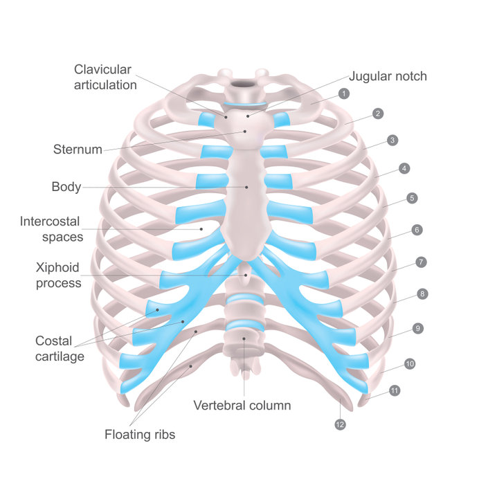 costochondral joint separation